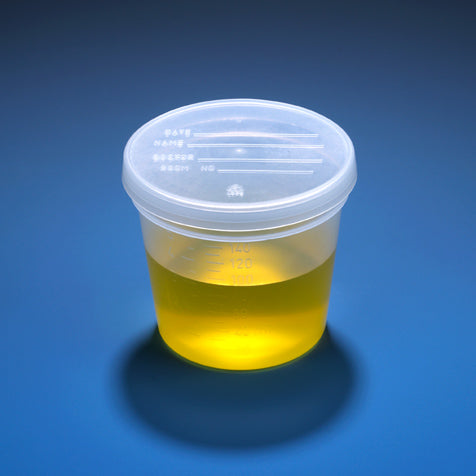 Specimen Container, 4oz, with 1/4-Turn Red Screwcap and Tri-Lingual ID Label, STERILE, PP, Individually Wrapped, Graduated